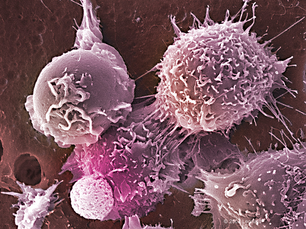 Hematopoietic Bone Marrow Stem Cells