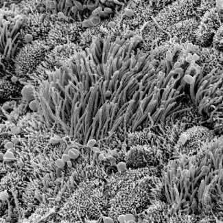 COVID-19 Infected Nasal Epithelial Tissue