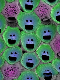  Bryozoan