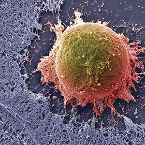 Human Embryonic Stem Cell