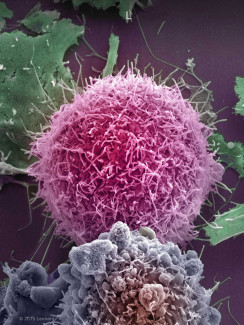 Melanoma Cells
