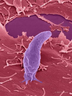 Toxoplasma gondii