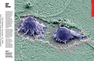 Human Embryonic Stem Cells  - Time Magazine Best Photos 2006