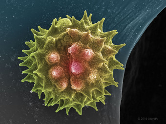 Central Park Pollen