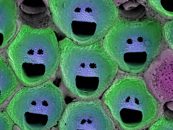  Bryozoan