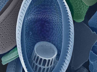 Hudson River Diatoms, diatoms