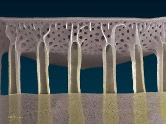 Hudson River Diatom Detail
