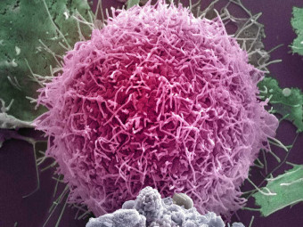 Melanoma Cells