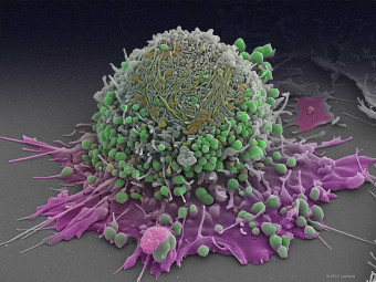 Prostate Cancer Cell