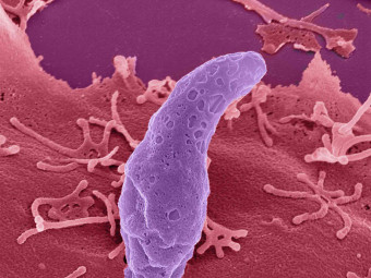 Toxoplasma gondii