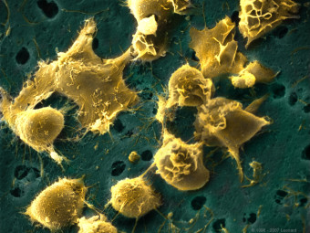 Hematopoietic Bone Marrow Stem Cells