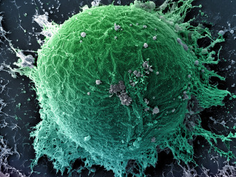 Human Embryonic Stem Cell