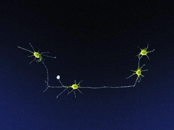 Chain of Neurons